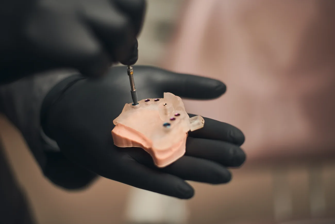 Modelo de implante dentário usado para explicar o tratamento.